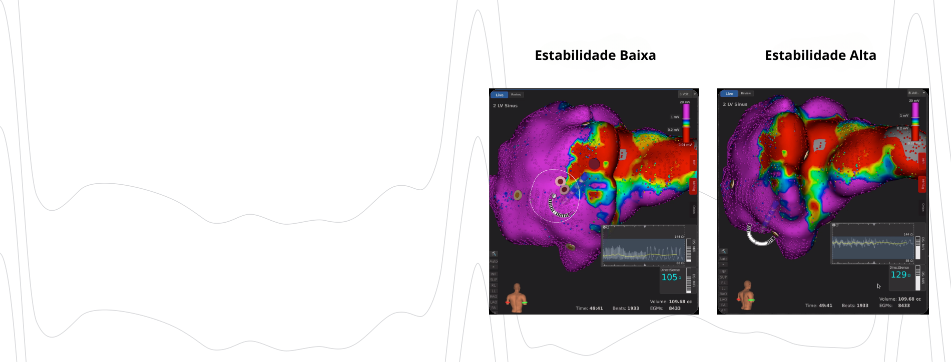RHYTHMIA HDx™ high-definition cardiac map and DIRECTSENSE™ Technology interface.
