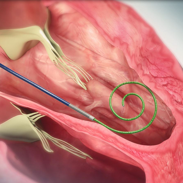 SAFARI2 PreShaped TAVR Guidewire Boston Scientific