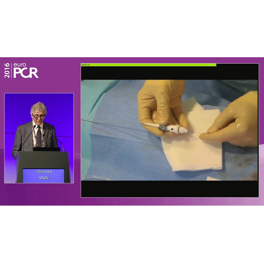 Watch how Professor Escaned simplified the treatment of Complex Multivessel disease with FFR guidance