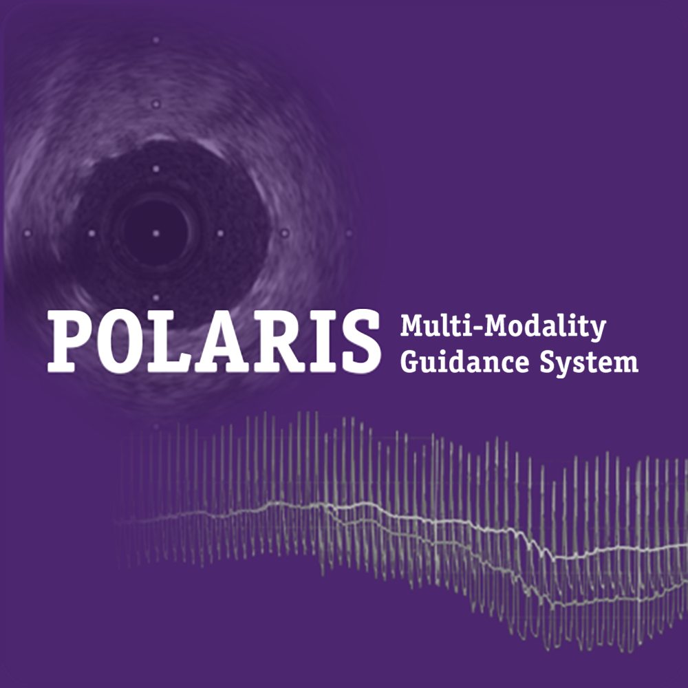 Navigate to better outcomes with the POLARIS Mutli-Modality Guidance System. Use a single system to inform treatment decisions with coronary physiology (FFR, DFRTM and Pd/Pa) and high-definition IVUS.