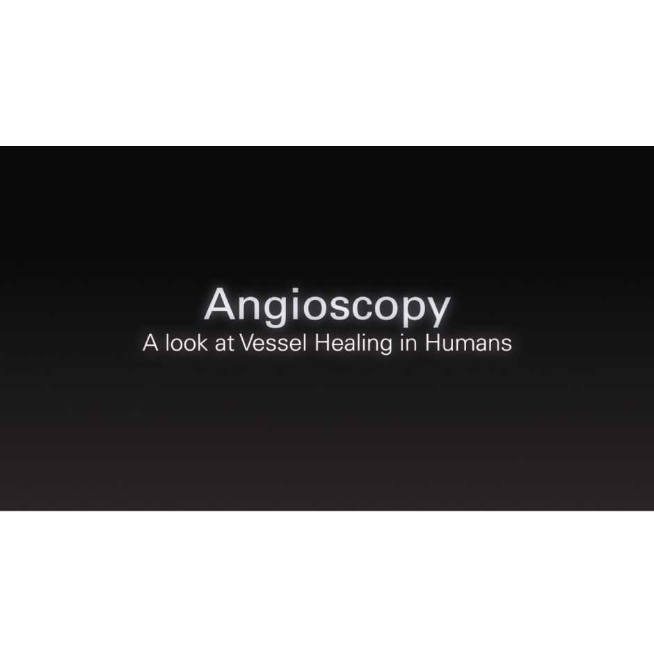 Curación vista a través de angioscopia
