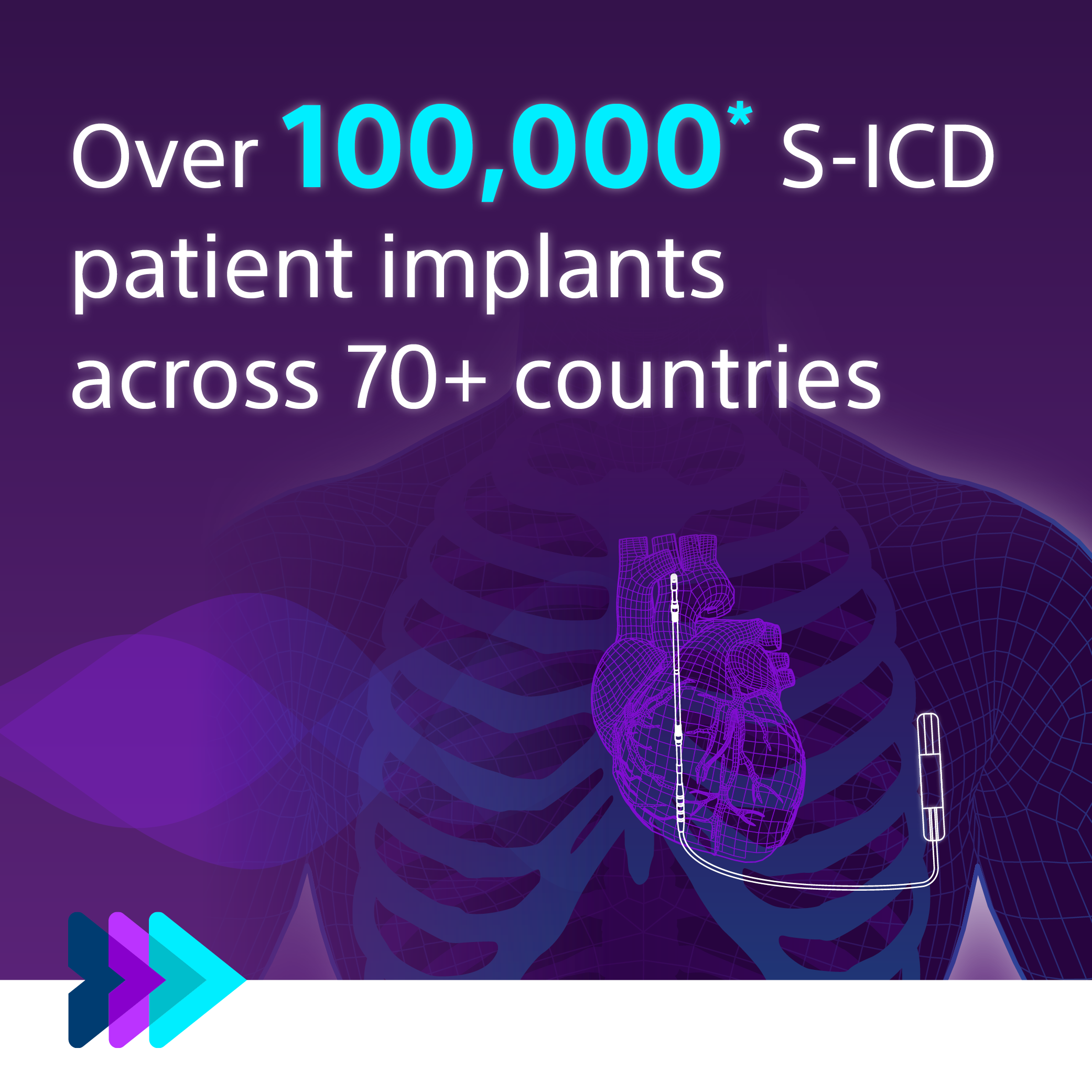 Over 100000 S-ICD patient implants across 70+ countries