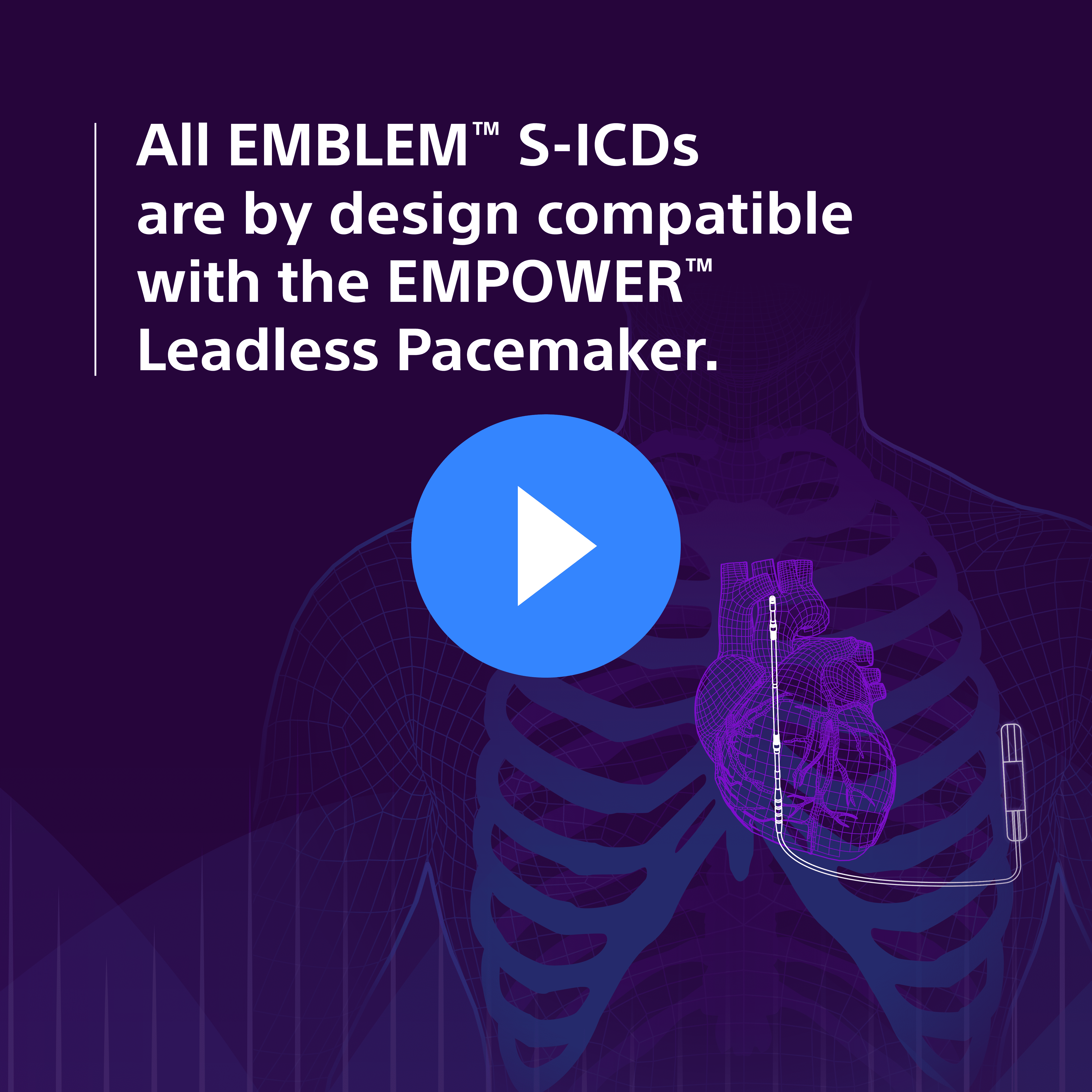 EMBLEM™ S-ICD Animación del torso