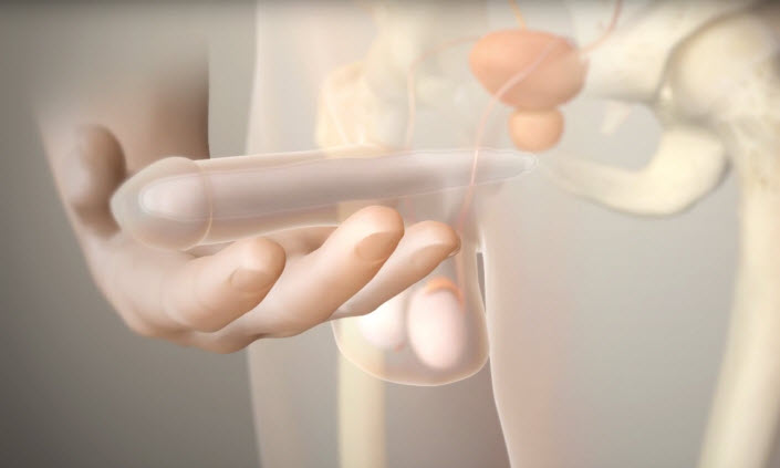 animation video showing how the Spectra penile implant works