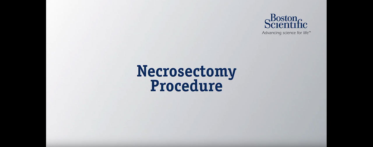 Necrosectomy Procedure