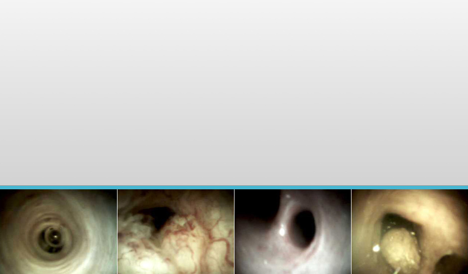 Images of benign and malignant conditions in the biliary and pancreatic ducts