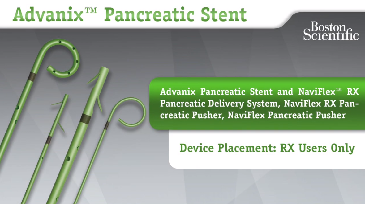 Advanix™ Pancreatic Stent Device Placement - RX Users Only