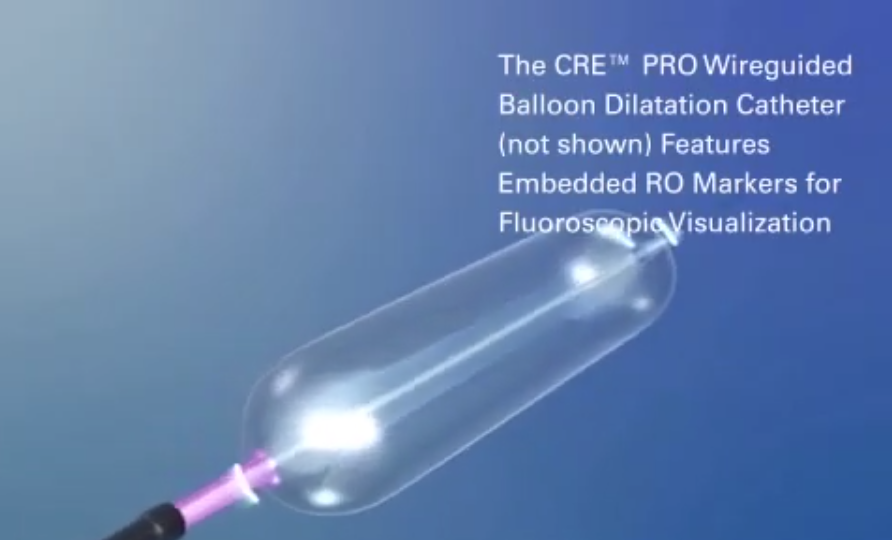 CRE™ Balloon Dilatation Catheter and Alliance™ II Integrated Inflation/Lithotripsy Device