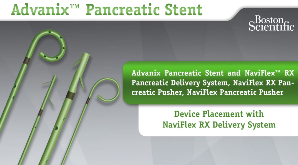 NaviFlex™ RX Delivery System Device Placement