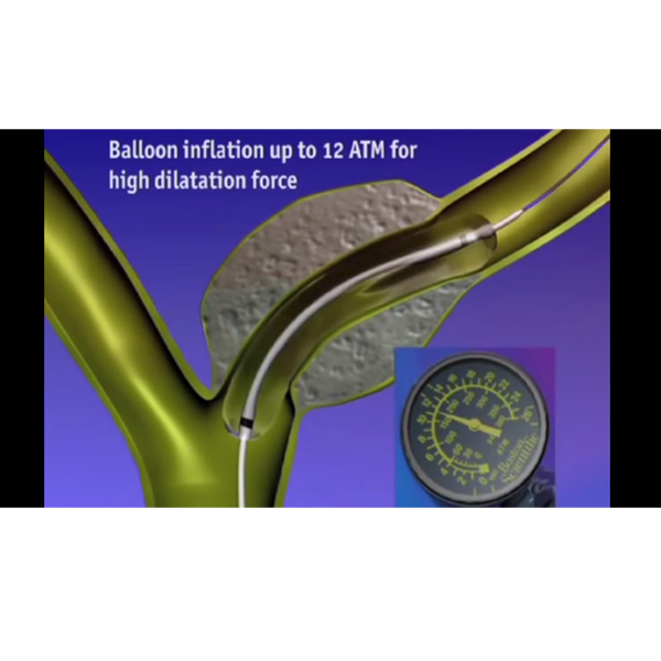 Animation shows inflation of balloon and use with compatible RX devices