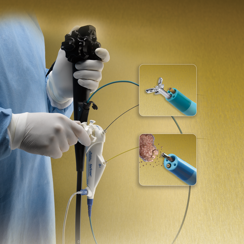 spyglass_catheter_with_therapeutic_inserts_600x600.png