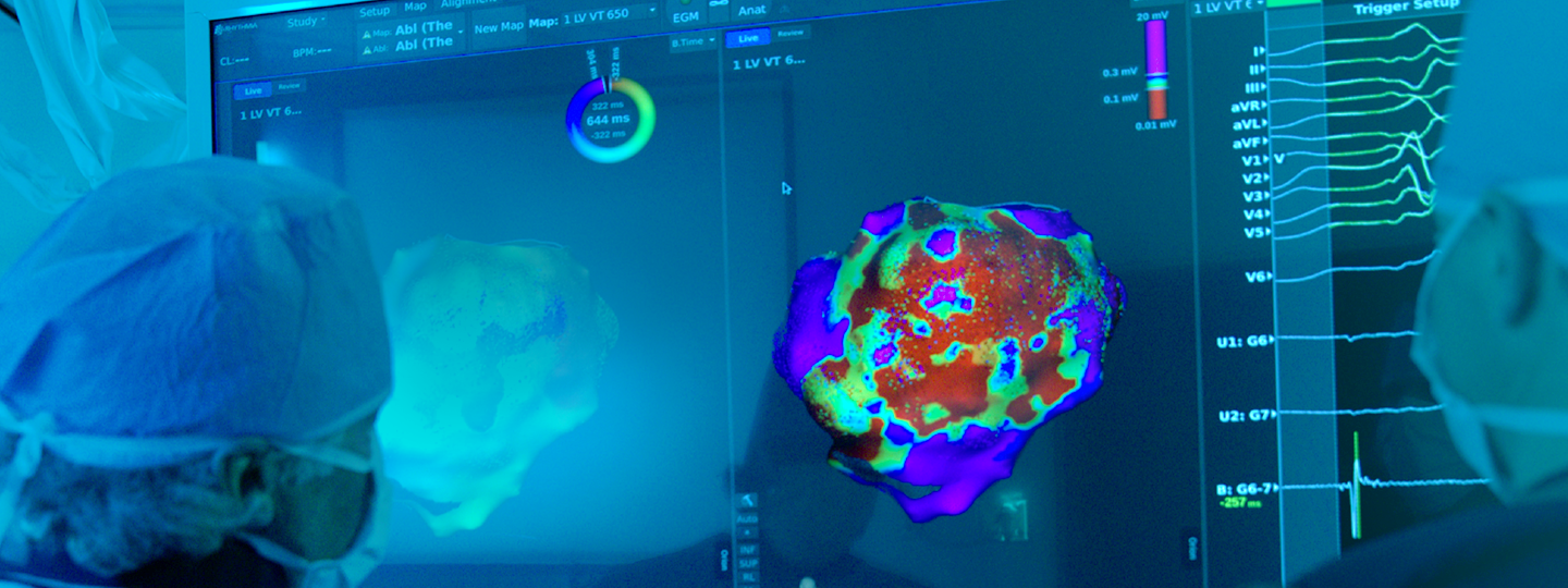 Physicians review high-definition cardiac maps using the RHYTHMIA HDx Mapping System