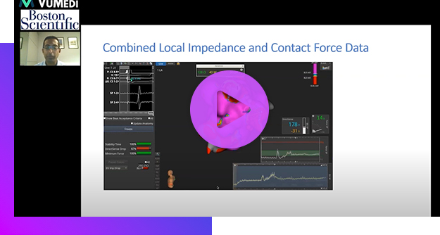 Contact Force and Local Impedance: Reviewing the Ablation Metrics