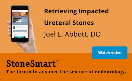 Retrieving Impacted Ureteral Stones with Joel E. Abbott, DO | StoneSmart(TM) The forum to advance the science of endourology.
