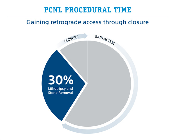 PCNL Procedural Time: Gaining retrograde access through closure - 30% Lithotripsy and Stone Removal