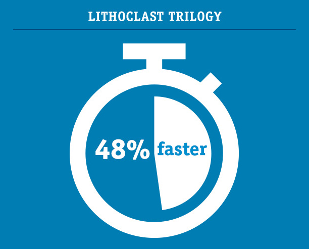 LithoClast Trilogy - 48% faster