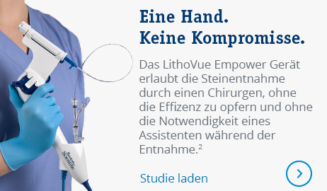 One Hand. No Compromises. The LithoVue Empower Device fits permitted single-surgeon stone capture without  sacrificing efficiency or the need  of an assistant during basketing. 2. View the published study.