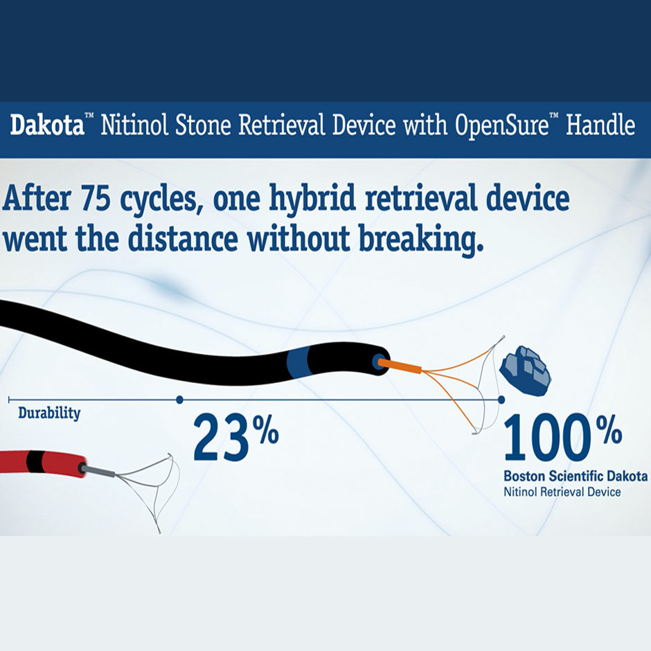 Infografía del dispositivo de recuperación de piedras Dakota ™