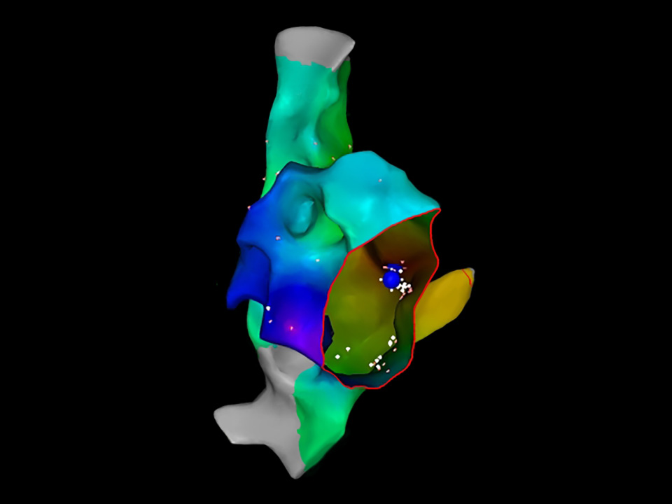 Diagnostic mapping image of the heart.