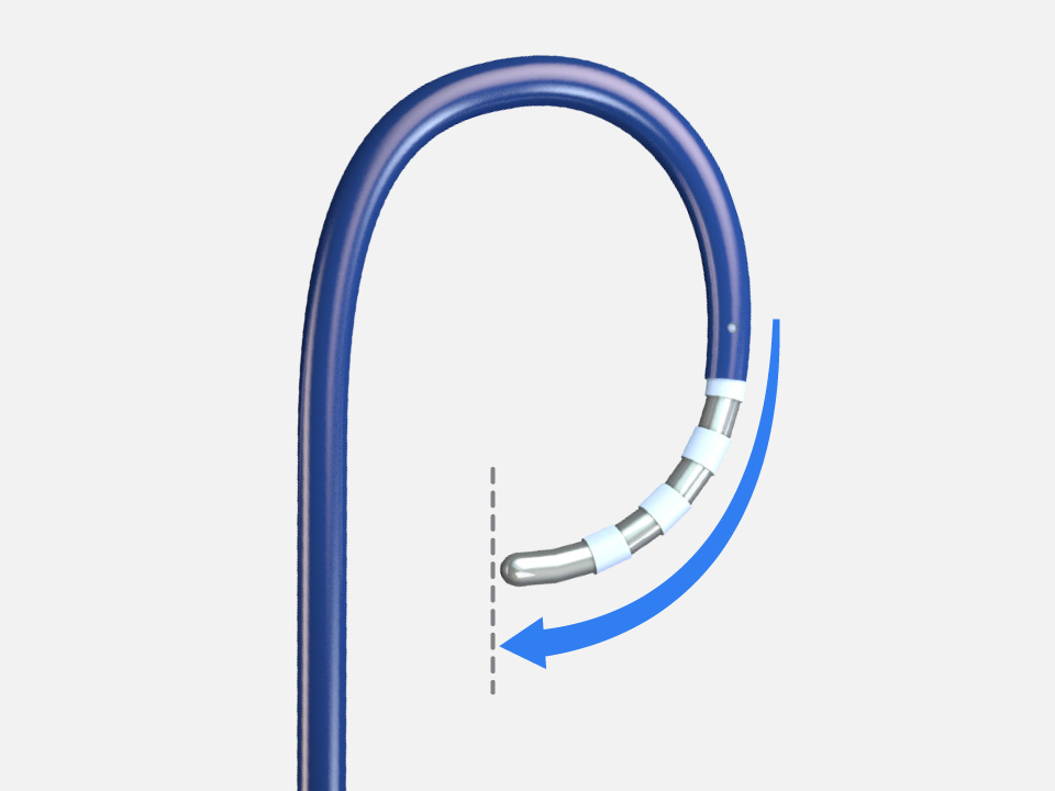 SureFlex Steerable Guiding Sheath in a 180-degree curved position with a compatible catheter.