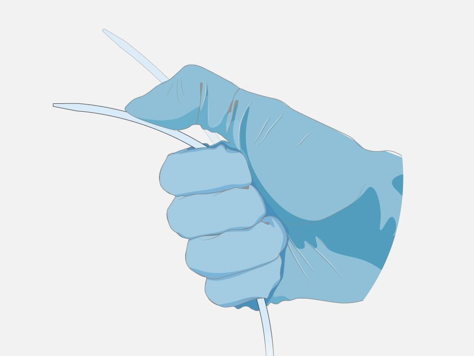 Hand in surgical glove bends the single, seamless transseptal dilator of the VersaCross Connect Access Solution for POLARSHEATH.