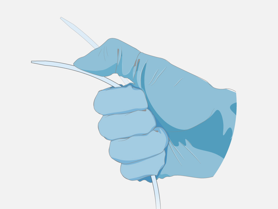 Hand in surgical glove bends the single, seamless transseptal dilator of the VersaCross Large Access Solution