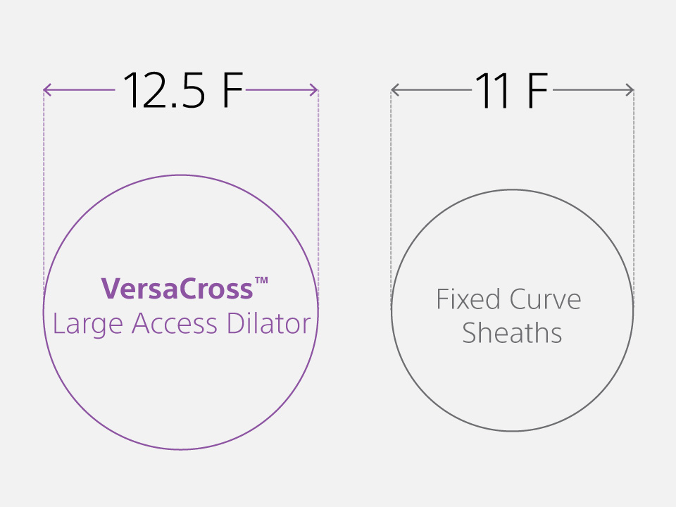 Infographic comparing the 12.5F size of the VersaCross Large Access Dilator with the 11F size of fixed curve sheaths.