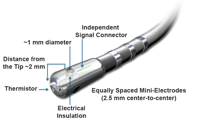 IntellaTip MiFi's Unique Catheter Design