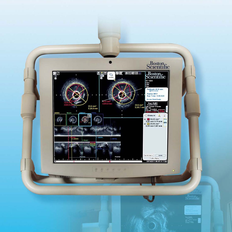 iLab™ Ultrasound Imaging System