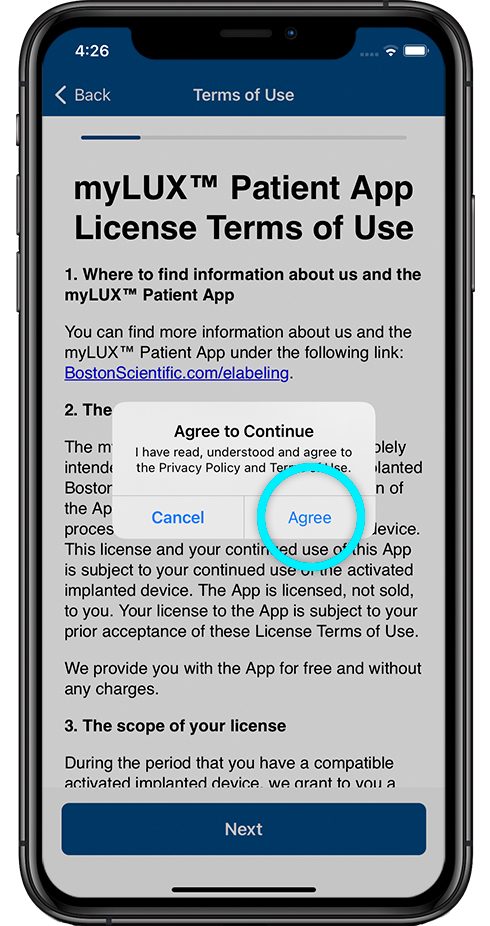 pantalla de condiciones de uso de la licencia con aviso para aceptar