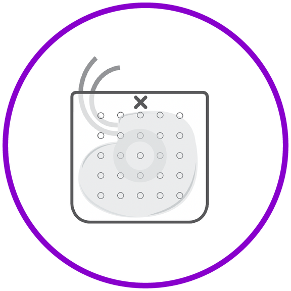 EluPro™ Antibiotic-Eluting BioEnvelope – Boston Scientific