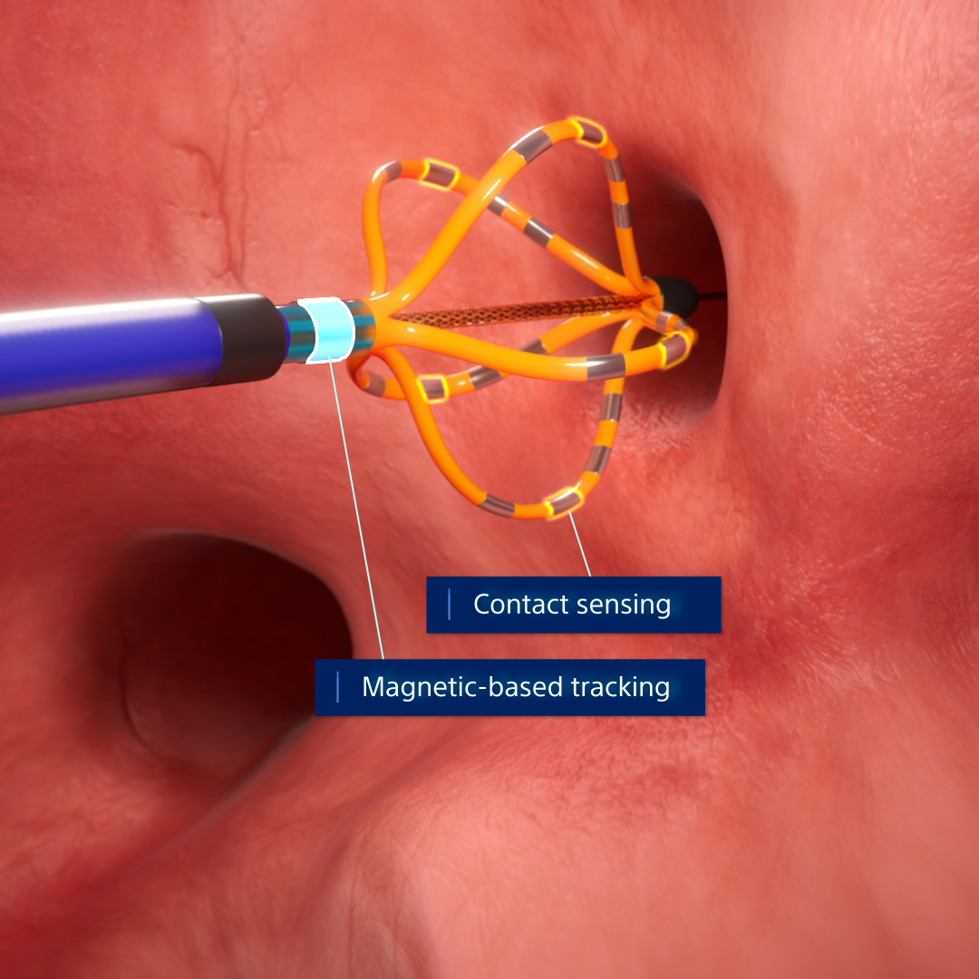 Farawave NAV catheter contact sensing