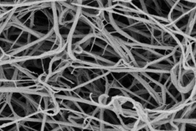 Fibrin ultrasound after EKOS treatment