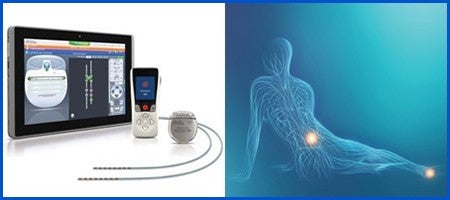 ニューロモジュレーション（ペインマネジメント）