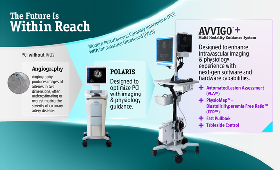 AVVIGO™+ - Boston Scientific