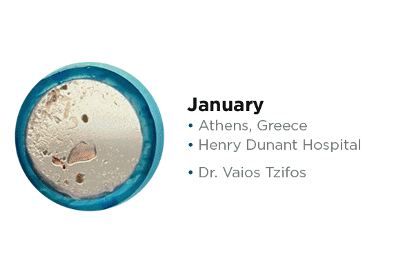 Debris captured donation campaign GIF