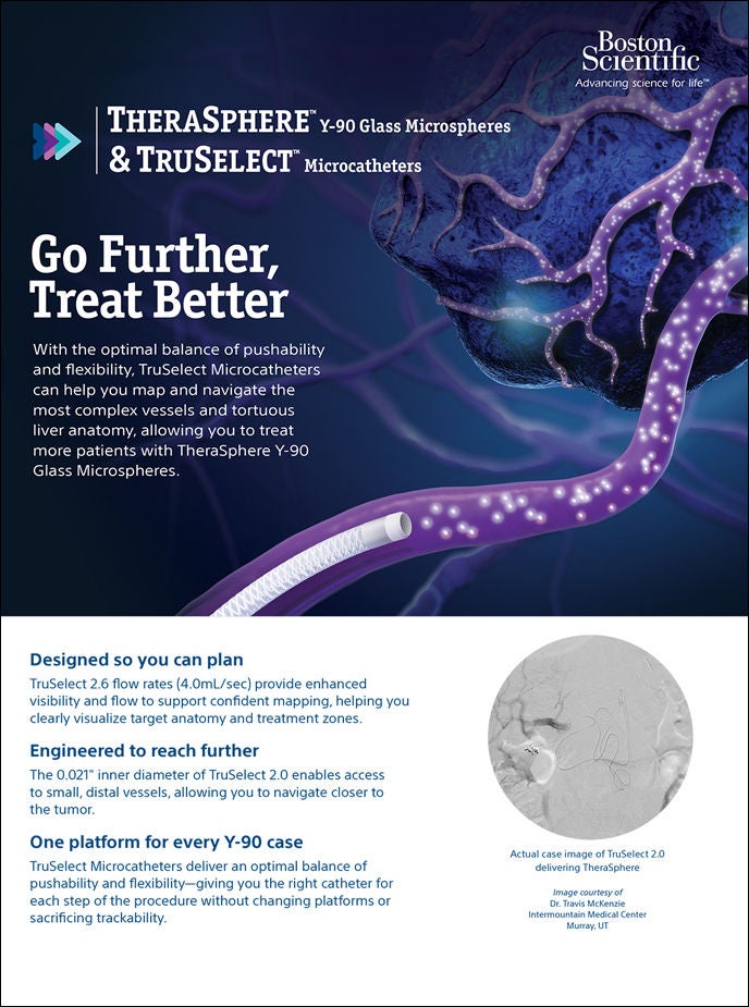 PDF TheraSphere + TruSelect™ Microcatheters.