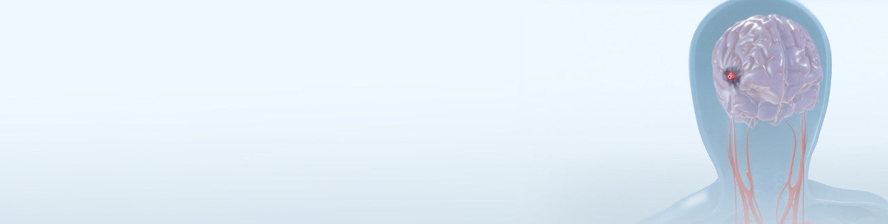 Minimize the risk of stroke during your TAVR procedure