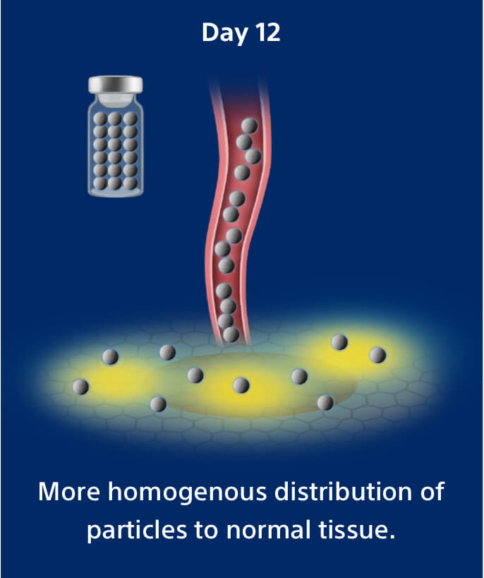 Day 12: More homogenous distribution of particles to normal tissue.