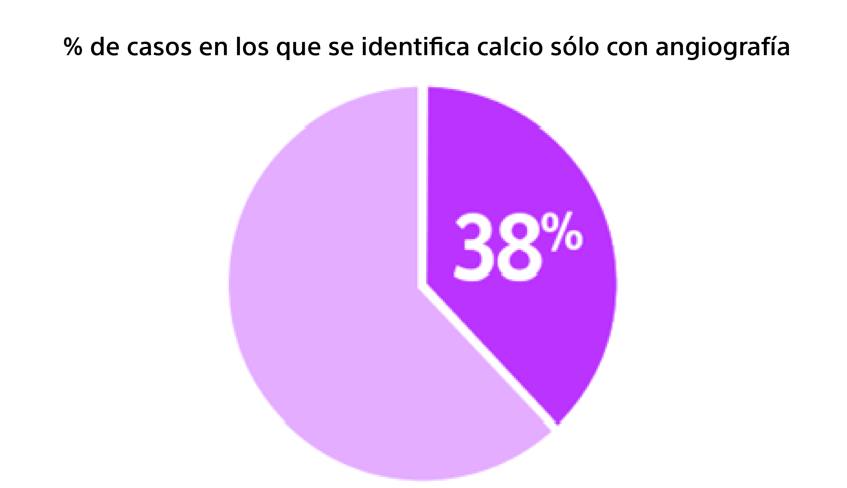 38% de casos en los que se identifica calcio sólo con angiografía         