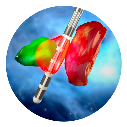 Therapy coverage shown on Cartesia X lead.