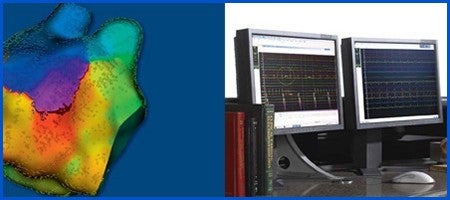 エレクトロフィジオロジー