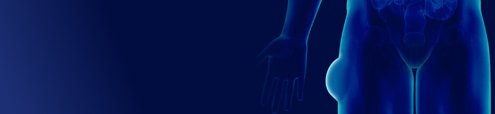 Body with soft tissue tumour highlighted