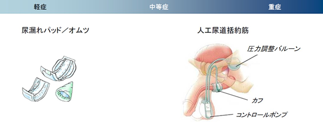 尿漏れの治療法