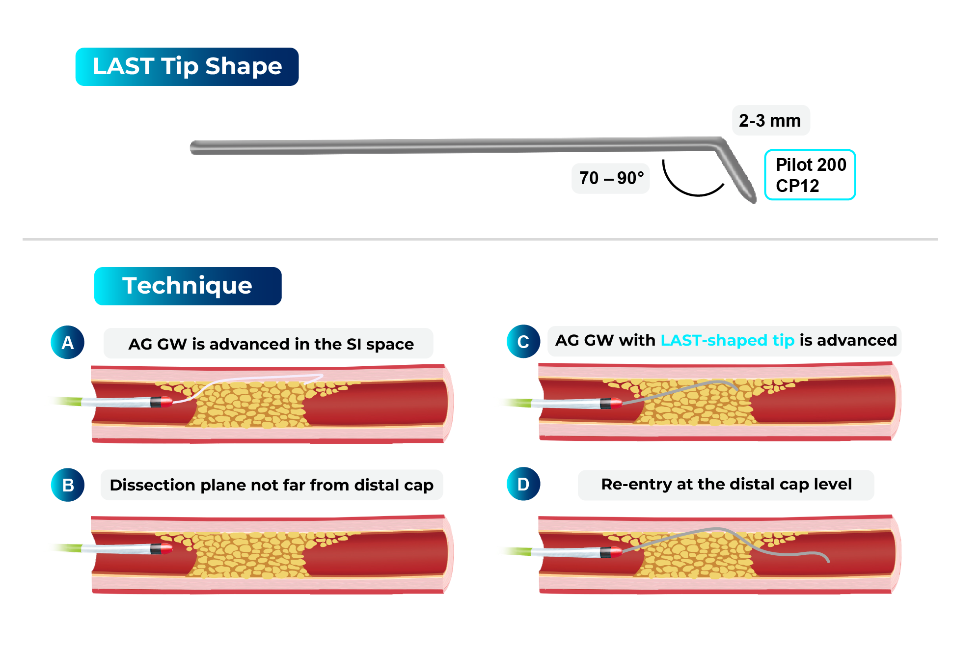Fast-Spin CROSSBOSSTM Catheter Technique