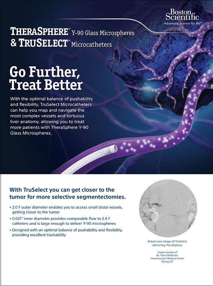 PDF TheraSphere + TruSelect™ Microcatheters.