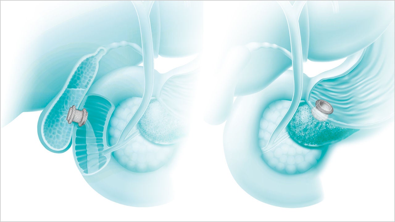 Hot AXIOS™ システム 適応と治療法