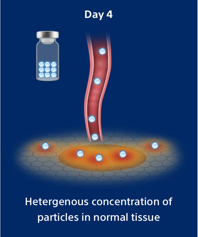 Day 4: Heterogenous concentration of particles in normal tissue.
