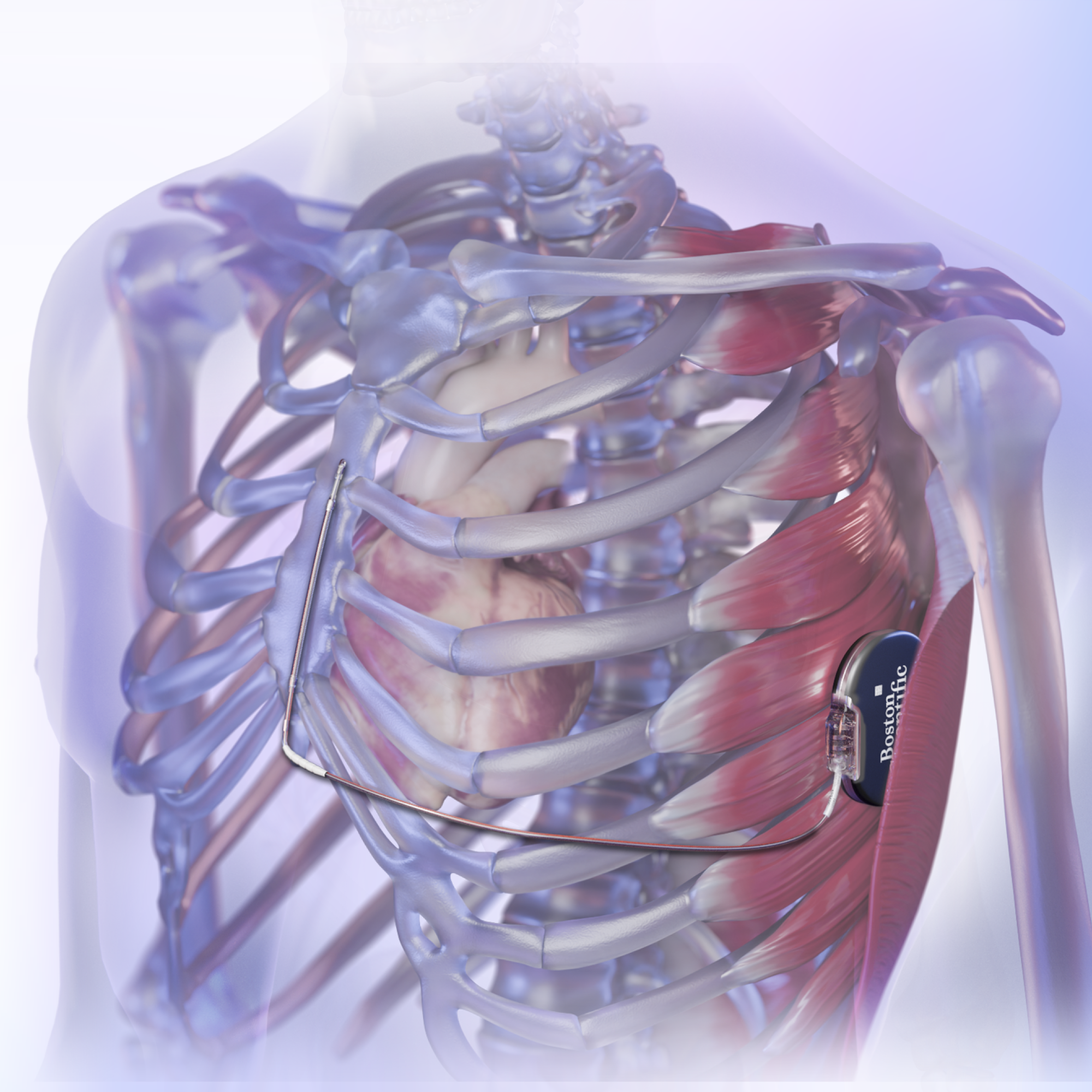The Modular CRM System includes the EMBLEM S-ICD and the EMPOWER leadless pacemaker.