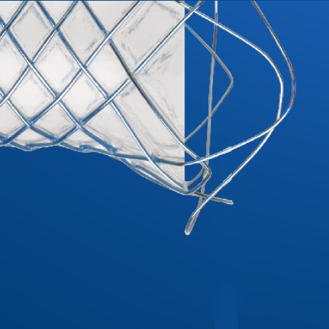 WallFlex Biliary PLUS Metal Stent zoomed in on the retrieval loop.